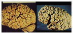 Postmortem human brains